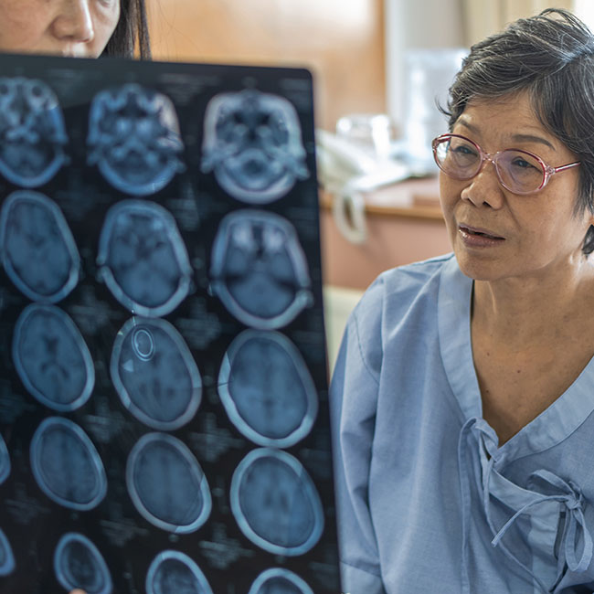 During a second opinion before brain surgery, a woman in a medical gown looks at her brain scan.
