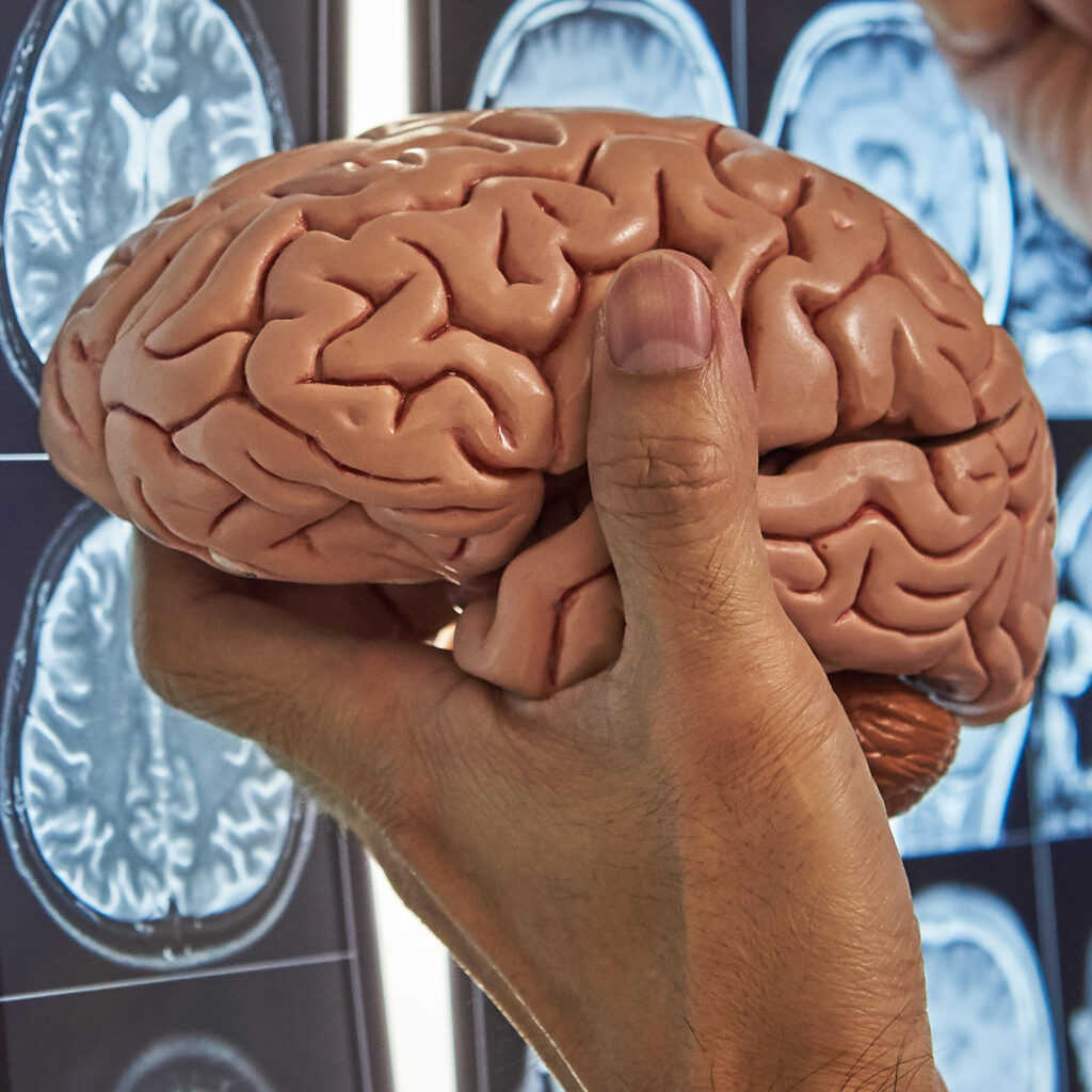 A neurosurgeon holding human brain model and pointing at brain MRI on lightbox in medical office