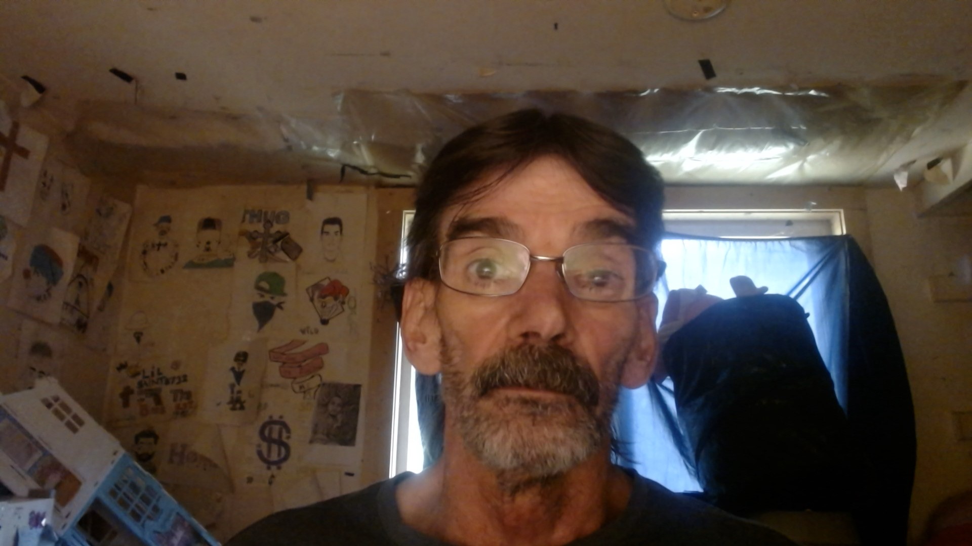 non-cancerous-brain-tumors-my-whole-life