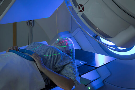 What to Expect: Radiation Therapy as a Patient With a Brain Tumor
