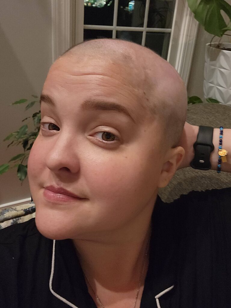 A woman without hair due to brain tumor radiation therapy looks at the camera with eyebrows raised.