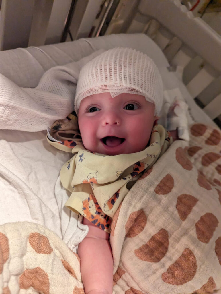 A 4-month-old boy lies in a hospital bed with a bandage wrap on his head and smiling.