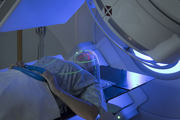 Woman Receiving Radiation Therapy (Radiotherapy) Treatment for Cancer of the Brain