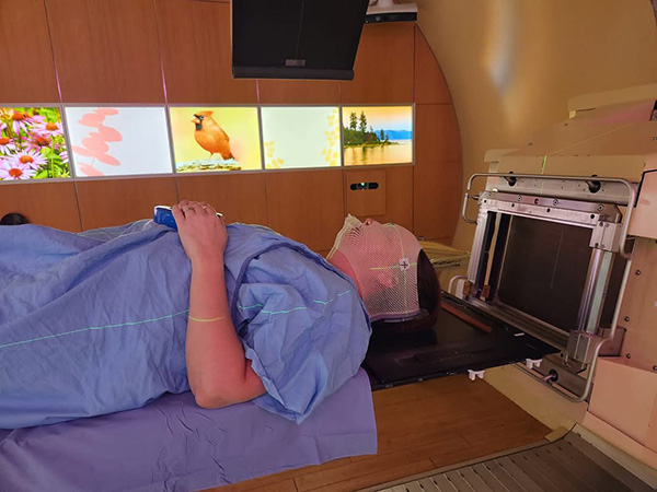 A woman lies flat with her head strapped to the table by a mask before brain tumor radiation begins