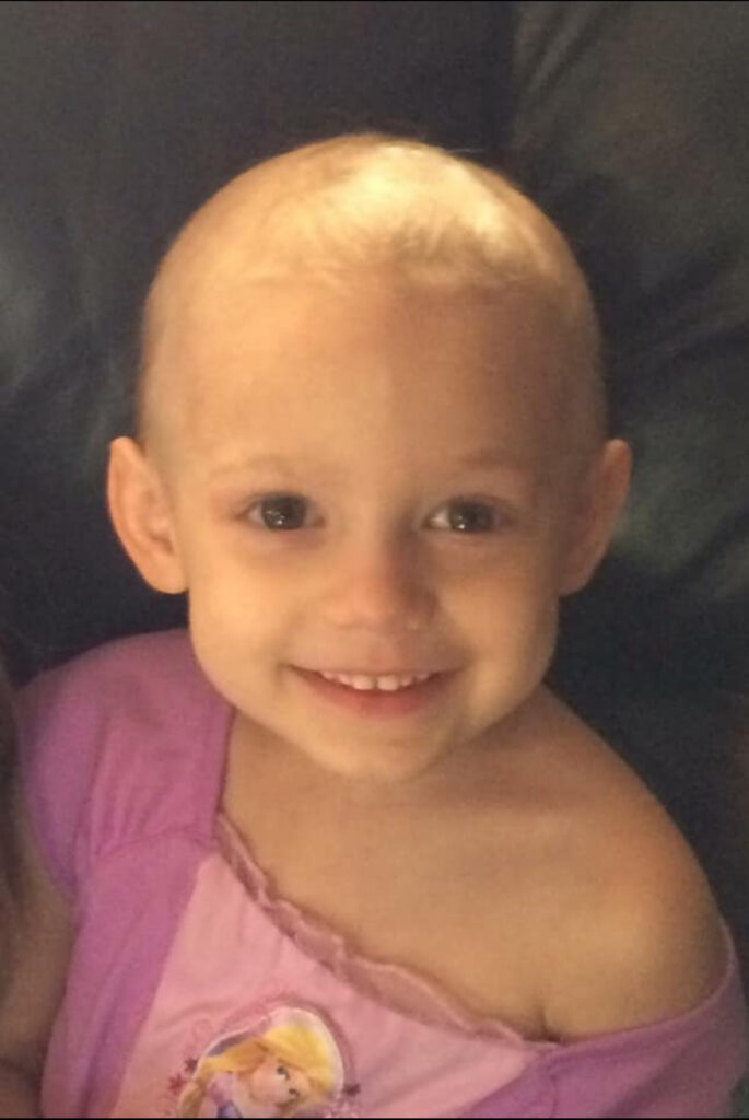 A young girl smiles while wearing a pink princess dress. She has no hair due to chemotherapy to treat juvenile pilocytic astrocytoma. 