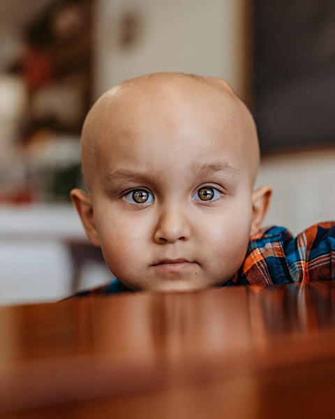 A toddler boy with a bald head from chemo and a plaid shirt stairs at the camera with his chin resting on a table. His ependymoma story includes surgery and radiation.